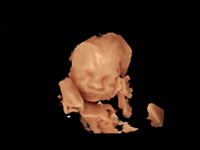 3D/4D Echo gezichtje: tussen 24-30 weken zwanger
