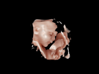 3D/4D Echo gezichtje: tussen 24-30 weken zwanger