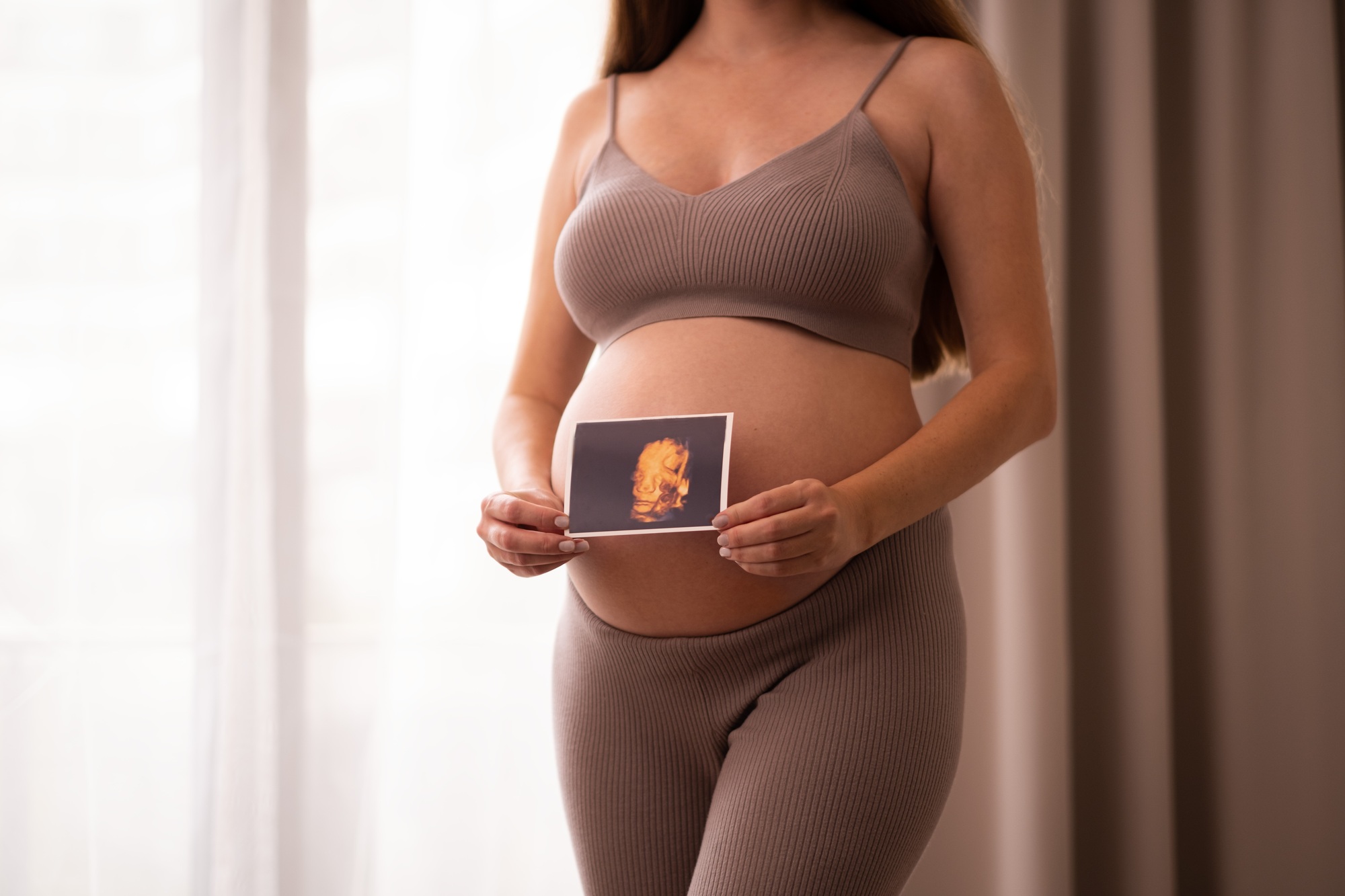 Unrecognizable caucasian pregnant woman holding ultrasound photo